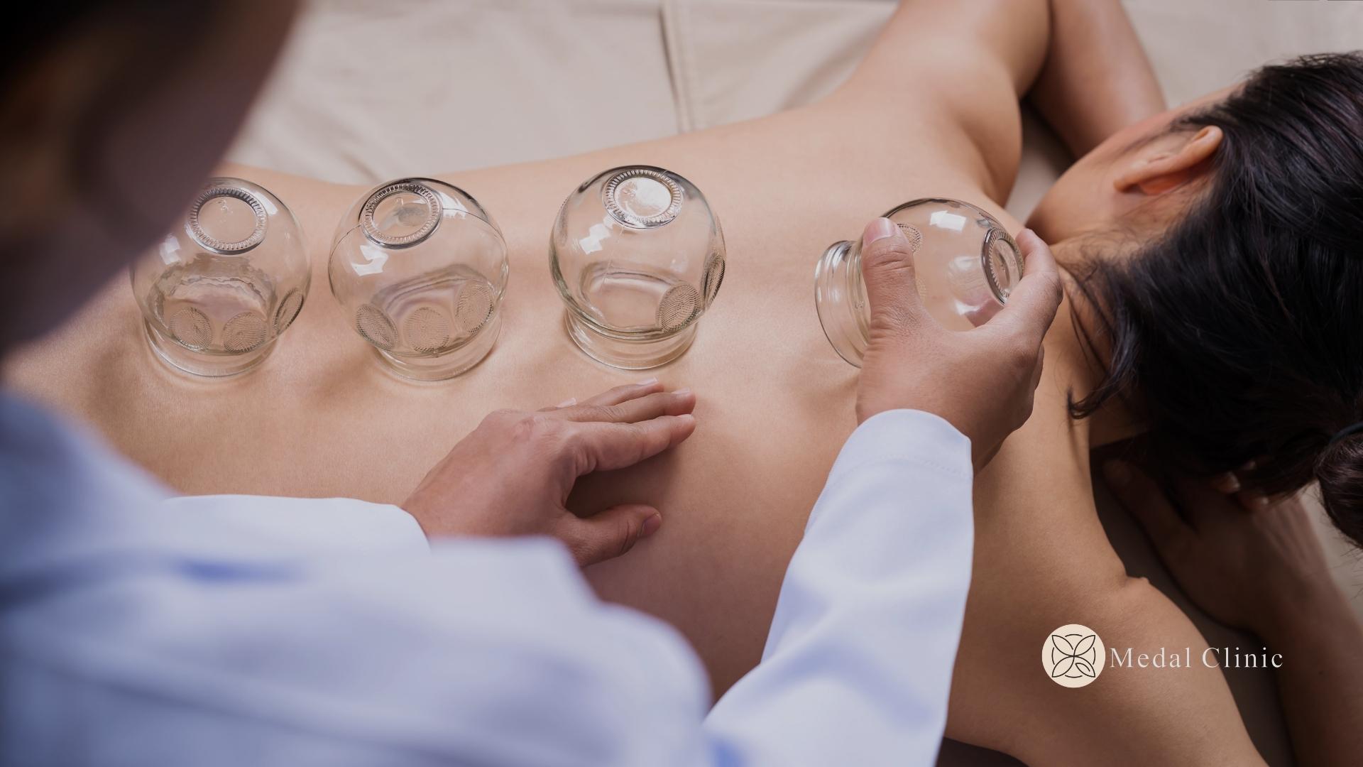 Cupping therapy, Alternative healing, Suction therapy, Traditional medicine, Qi circulation, Holistic wellness, Pain relief, Blood circulation, Ancient techniques, Therapeutic benefits, cupping therapy manavgat, medal clinic, antalya hacamat, hacamat tedavisi manavgat, hacamat tedavisi, hacamat manavgat.